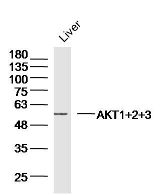 蛋白激酶AKT1,2,3抗体