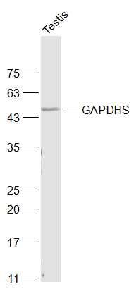 精子3-磷酸甘油醛脱氢酶-2抗体