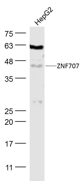锌指蛋白707抗体