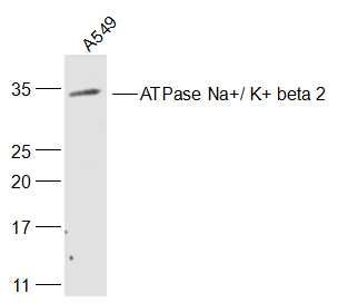 钠钾ATP酶通道蛋白（内参）抗体