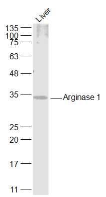 精氨酸酶1抗体