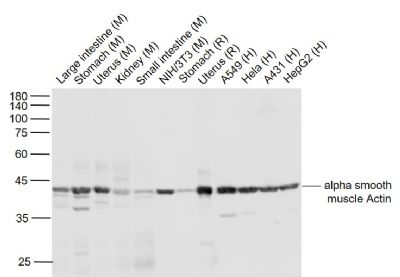 肌动蛋白a/a-SMA/a Actin单克隆抗体