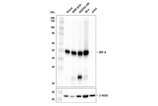 IRF-4 (E8H3S) XP Rabbit mAb