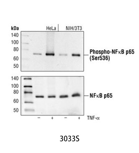 [003.3033S] Phospho-NF-κB p65 (Ser536) (93H1) Rabbit mAb [100ul]