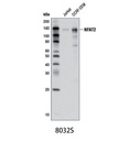 Phospho-p44/42 MAPK (Erk1/2) (Thr202/Tyr204) (D13.14.4E) XP Rabbit mAb