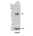 PD-L1 (E1L3N) XP Rabbit mAb