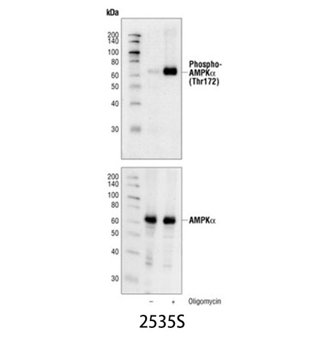 [003.2535S] Phospho-AMPKα (Thr172) (40H9) Rabbit mAb [100ul]