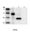 Myc-Tag (9B11) Mouse mAb