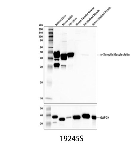 [003.19245S] α-Smooth Muscle Actin (D4K9N) XP Rabbit mAb [100ul]