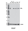 NF-κB Pathway Sampler Kit