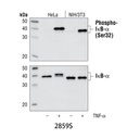 Phospho-IκBα (Ser32) (14D4) Rabbit mAb