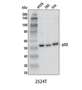 p53 (1C12) Mouse mAb