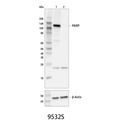 PARP (46D11) Rabbit mAb