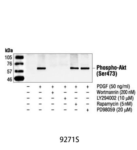[003.9271S] Phospho-Akt (Ser473) Antibody [100ul]