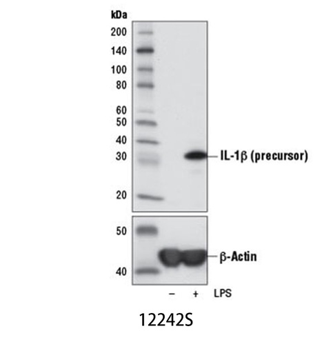 [003.12242S] IL-1β (3A6) Mouse mAb [100ul]