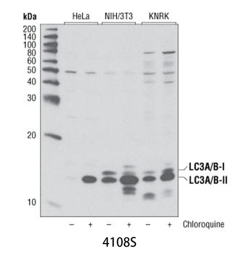 [003.4108S] LC3A/B Antibody [100ul]