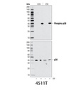 Phospho-p38 MAPK (Thr180/Tyr182) (D3F9) XP Rabbit mAb