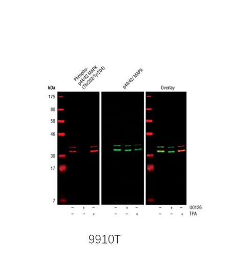 [003.9910T] Phospho-MAPK Family Antibody Sampler Kit [1Kit]