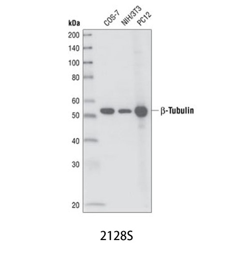 [003.2128S] β-Tubulin (9F3) Rabbit mAb [100ul]
