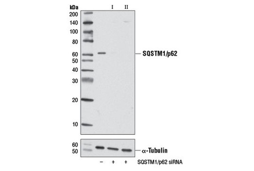 [003.6394S] SignalSilence SQSTM1/p62 siRNA I [300ul]