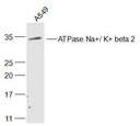 钠钾ATP酶通道蛋白（内参）抗体