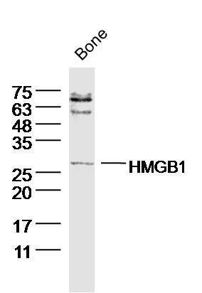 [116.bs-0664R-50ul] 高迁移率族蛋白B1抗体 [50ul]