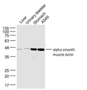 肌动蛋白a/a-SMA/a Actin抗体