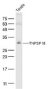 肿瘤坏死因子配体超家族成员18抗体