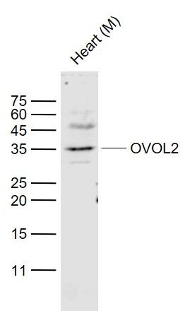 [116.bs-12274R-50ul] 锌指蛋白339抗体 [50ul]