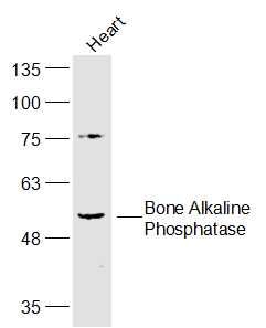 [116.bs-6292R-50ul] 骨碱性磷酸酶抗体 [50ul]