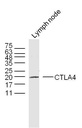 细胞毒性T细胞抗原-4抗体