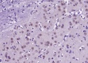 细胞凋亡诱导蛋白NALP3抗体
