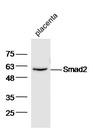 细胞信号转导分子Smad-2抗体