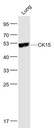 细胞角蛋白15抗体