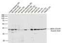 肌动蛋白a/a-SMA/a Actin单克隆抗体